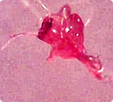 http://x51.org/x/images2005/morgellons.jpg